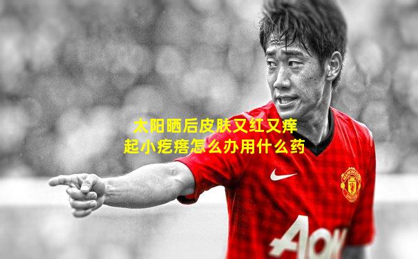 太阳晒后皮肤又红又痒起小疙瘩怎么办用什么药